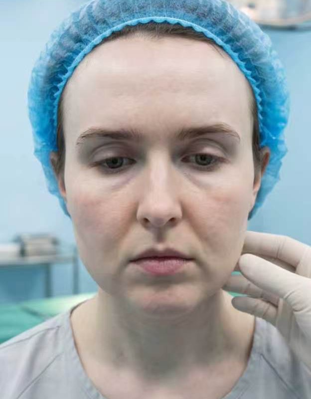 Before treatment photograph for patient case 02